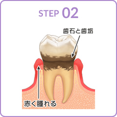 STEP02