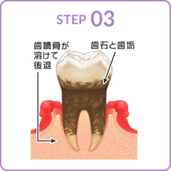 STEP03