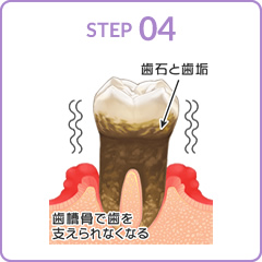 STEP04